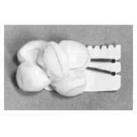 Teleflex #200334, SPONGE, TONSIL, LG, GAUZE, STERILE, 500/BX Image Teleflex #200334, SPONGE, TONSIL, LG, GAUZE, STERILE, 500/BX Image